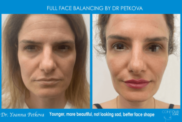 FULL FACE